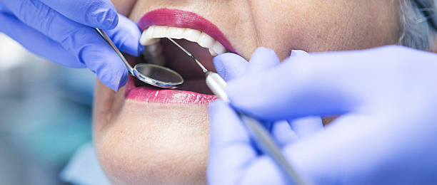 Best Urgent Dental Care for Toothaches in Montvale, NJ